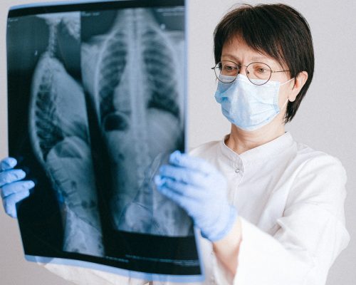 Bronchoscopy Bronchoscopy