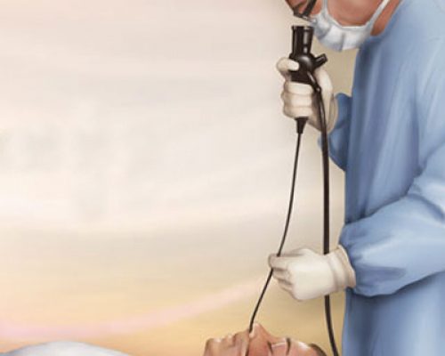Bronchoscopy4 Bronchoscopy4