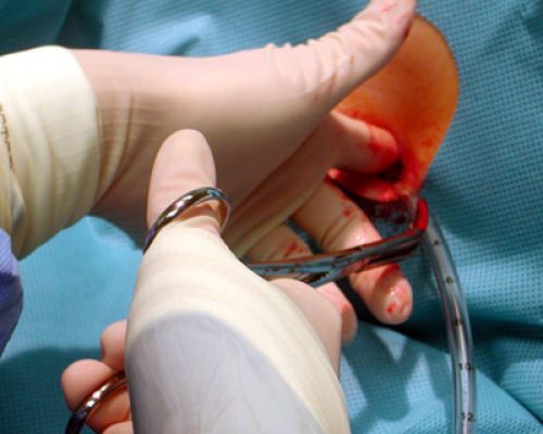 chest-tube4