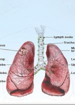lungcancer